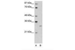 Image no. 1 for anti-Cellular Repressor of E1A-Stimulated Genes 1 (CREG1) (N-Term) antibody (ABIN6736607)