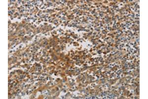 The image on the left is immunohistochemistry of paraffin-embedded Human tonsil tissue using ABIN7190267(CKMT1A/CKMT1B Antibody) at dilution 1/80, on the right is treated with synthetic peptide. (CKMT1A antibody)