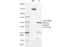 SDS-PAGE Analysis Purified MYC Mouse Monoclonal Antibody (MYC699). (c-MYC antibody  (C-Term))