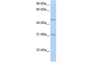 WB Suggested Anti-SLC39A11 Antibody Titration:  0. (SLC39A11 antibody  (Middle Region))