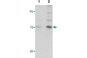 Western blot analysis of BALB/3T3 cells with ARHGAP18 polyclonal antibody  at (Lane 1) 1 and (Lane 2) 2 ug/mL dilution. (ARHGAP18 antibody  (C-Term))
