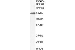 ABIN1590055 (2µg/ml) staining of Mouse Testes lysate (35µg protein in RIPA buffer). (HIC1 antibody  (AA 193-204))