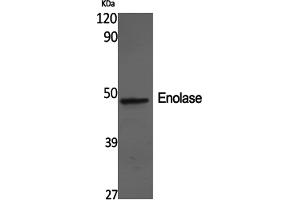 Western Blotting (WB) image for anti-Enolase 2 (Gamma, Neuronal) (ENO2) antibody (ABIN5960961) (ENO2/NSE antibody)