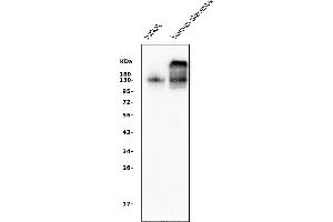 Western blot analysis of CD31/PECAM1 using anti-CD31/PECAM1 antibody (ABIN7601076).