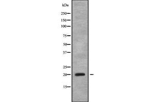 Western blot analysis of CABP5 using Jurkat whole cell lysates (CABP5 antibody  (N-Term))