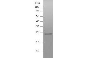 Western Blotting (WB) image for Zinc Finger CCCH-Type, Antiviral 1 (ZC3HAV1) (AA 190-377) protein (His tag) (ABIN7282841) (ZC3HAV1 Protein (AA 190-377) (His tag))