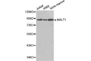 Western blot analysis of extracts of various cell lines, using MALT1 antibody. (MALT1 antibody  (AA 125-450))