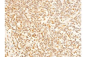 ABIN6267237 at 1/100 staining human appendiceal tissue sections by IHC-P. (FOXO3 antibody  (pSer253))