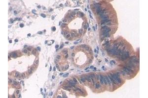 Detection of PTCH1 in Mouse Uterus Tissue using Polyclonal Antibody to Patched Homolog 1 (PTCH1) (Patched 1 antibody  (AA 213-422))