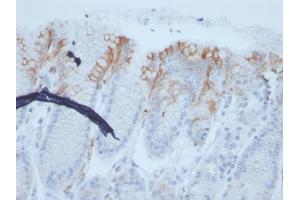 Formalin-fixed, paraffin-embedded human stomach stained with MUC2 Recombinant Mouse Monoclonal Antibody (rMLP/842). (Recombinant MUC2 antibody)