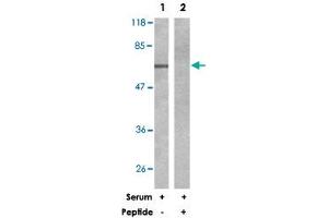 Western blot analysis of extracts from 293 cells, untreated or treated with serum (15 %), using RPS6KB1 polyclonal antibody . (RPS6KB1 antibody)