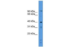 WB Suggested Anti-PRSS23 Antibody Titration: 0. (PRSS23 antibody  (C-Term))
