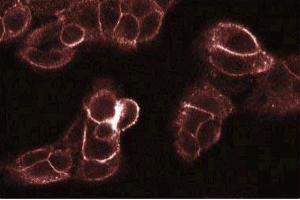 Immunofluorescence staining of A431 cells. (PKC theta antibody  (AA 21-217))