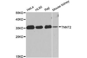 Western blot analysis of extracts of various cell lines, using TNNT2 antibody (ABIN5970474) at 1/1000 dilution. (Cardiac Troponin T2 antibody)