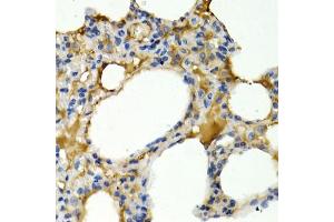 Immunohistochemistry of paraffin-embedded rat lung using IL9 antibody (ABIN5974970) at dilution of 1/200 (40x lens). (IL-9 antibody)