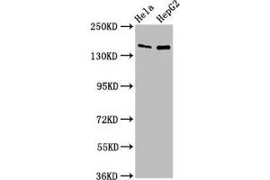 Western Blot Positive WB detected in: Hela whole cell lysate, HepG2 whole cell lysate All lanes: SULF1 antibody at 4 μg/mL Secondary Goat polyclonal to rabbit IgG at 1/50000 dilution Predicted band size: 102 kDa Observed band size: 150 kDa (SULF1 antibody  (AA 105-372))