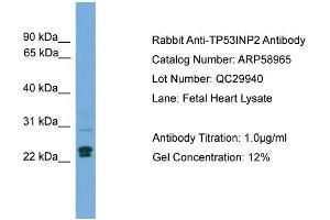 WB Suggested Anti-TP53INP2  Antibody Titration: 0. (TP53INP2 antibody  (C-Term))