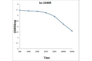 Antigen: 0. (IRAK4 antibody  (AA 21-120))