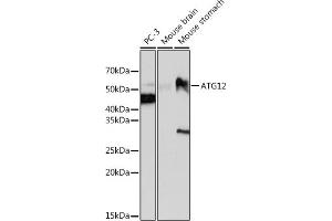 Western blot analysis of extracts of various cell lines, using  antibody (ABIN7265788) at 1:1000 dilution. (ATG12 antibody)