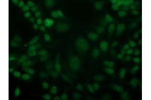 Image no. 2 for anti-Cyclin-Dependent Kinase 2 (CDK2) antibody (ABIN1497398) (CDK2 antibody)