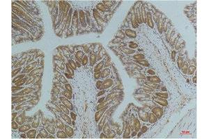 Immunohistochemistry (IHC) analysis of paraffin-embedded Mouse ColonTissue using AMPK a1 Mouse Monoclonal Antibody diluted at 1:200. (PRKAA1 antibody)