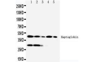 Anti-Haptoglobin antibody, Western blotting Lane 1:RAJI Cell Lysate Lane 2:HL-60 Cell Lysate Lane 3:HUT102 Cell Lysate Lane 4:JURKAT Cell Lysate Lane 5:CEM Cell Lysate (Haptoglobin antibody  (Middle Region))