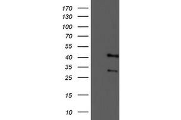 Tropomodulin 1 antibody