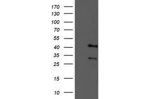 Western Blotting (WB) image for anti-Tropomodulin 1 (TMOD1) antibody (ABIN1501528) (Tropomodulin 1 antibody)