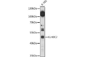 Western blot analysis of extracts of K-562 cells, using KLHDC2 antibody (ABIN7268073) at 1:1000 dilution.