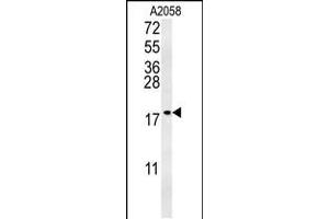 Western blot analysis in A2058 cell line lysates (35ug/lane). (GM2A antibody  (N-Term))
