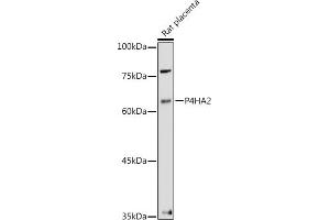 Western Blotting (WB) image for anti-Prolyl 4-Hydroxylase, alpha Polypeptide II (P4HA2) (AA 234-533) antibody (ABIN1681193)