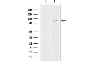 Western blot analysis of lysates from Hela cells, using GGCX Antibody.