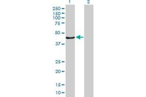 Western Blot analysis of PTPN2 expression in transfected 293T cell line by PTPN2 MaxPab polyclonal antibody. (PTPN2 antibody  (AA 1-387))
