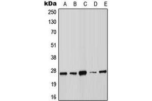 Western blot analysis of SOCS3 expression in MOLT4 (A), A431 (B), MCF7 (C), Raw264.