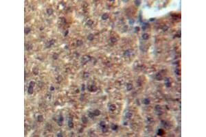 Used in DAB staining on fromalin fixed paraffin-embedded Liver tissue (CCL3L1 antibody  (AA 1-93))