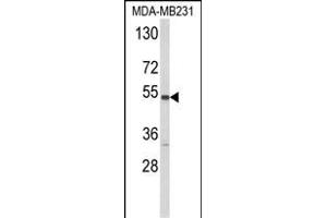 Western blot analysis of CYP2A13 Antibody (C-term) (ABIN652591 and ABIN2842396) in MDA-M cell line lysates (35 μg/lane). (CYP2A13 antibody  (C-Term))