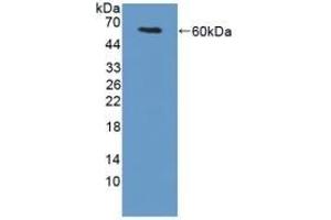 Detection of Recombinant TGM1, Mouse using Polyclonal Antibody to Transglutaminase 1 (TGM1) (TGM1 antibody  (AA 337-607))