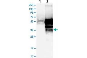 Western blot analysis of Lane 1: Negative control (vector only transfected HEK293T lysate), Lane 2: Over-expression Lysate (Co-expressed with a C-terminal myc-DDK tag (~3. (TMED8 antibody)