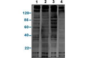 Western blot analysis of a panel of phosphotyrosine antibodies with EGF-stimulated A431 cell lysates.