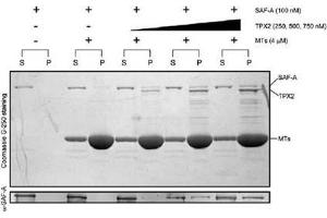 Bioactivity measured with Activity Assay (TPX2 Protein (Myc-DYKDDDDK Tag))