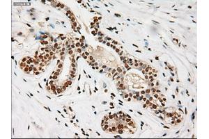 Immunohistochemical staining of paraffin-embedded breast using anti-Notch1 (ABIN2452671) mouse monoclonal antibody.