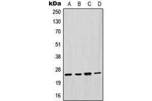 Western blot analysis of GSTM2 expression in HepG2 (A), HeLa (B), mouse liver (C), rat liver (D) whole cell lysates. (GSTM2 antibody  (Center))