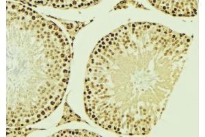 ABIN6276953 at 1/100 staining Mouse testis tissue by IHC-P. (MNAT1 antibody  (N-Term))