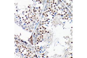 Immunohistochemistry of paraffin-embedded mouse testis using RGS14 Rabbit pAb (ABIN6130669, ABIN6146917, ABIN6146918 and ABIN6225301) at dilution of 1:100 (40x lens). (RGS14 antibody  (AA 230-510))