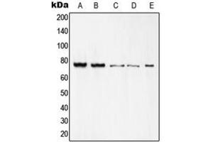 Western blot analysis of c-Rel expression in K562 (A), Raw264.