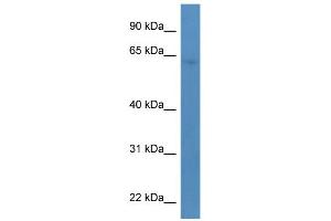WB Suggested Anti-TBC1D10A Antibody Titration: 0.