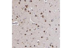 Immunohistochemical staining of human cerebral cortex with MAGEE1 polyclonal antibody  shows strong cytoplasmic positivity in neuronal cells at 1:20-1:50 dilution. (MAGEE1 antibody)