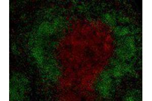 Immunofluorescence (IF) image for anti-CD3 (CD3) antibody (Alexa Fluor 594) (ABIN2656824) (CD3 antibody  (Alexa Fluor 594))
