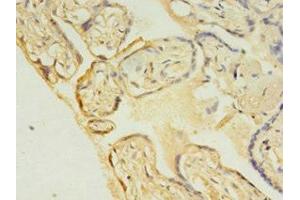 Immunohistochemistry of paraffin-embedded human placenta tissue using ABIN7174430 at dilution of 1:100 (UBE2C antibody  (AA 2-179))