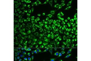 Immunofluorescence analysis of MCF-7 cells using CYP51A1 Polyclonal Antibody (CYP51A1 antibody)